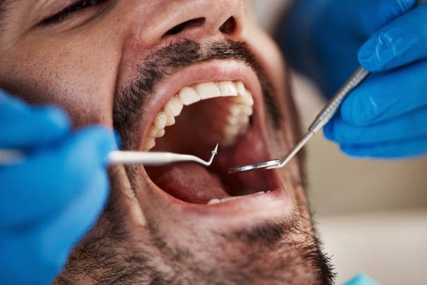 Best Emergency Broken Tooth Repair in Bernalillo, NM
